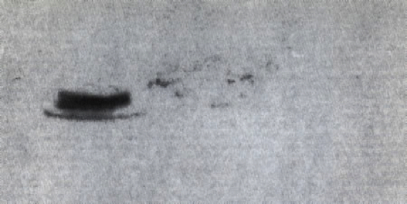 Heflin UFO Photos (1965)